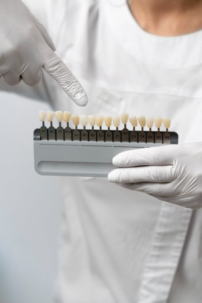 Lentes de Contato Dental